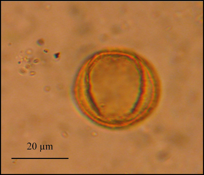 Pollen de Chêne décidu
