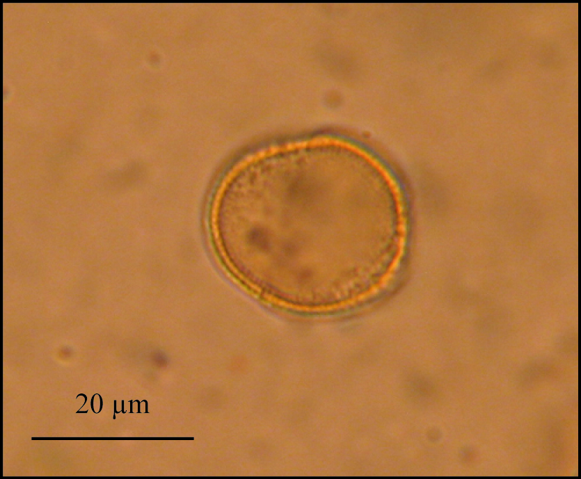 Pollen de Platane