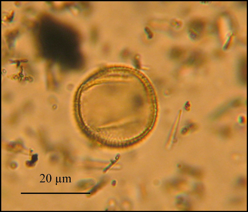 Pollen de Frêne