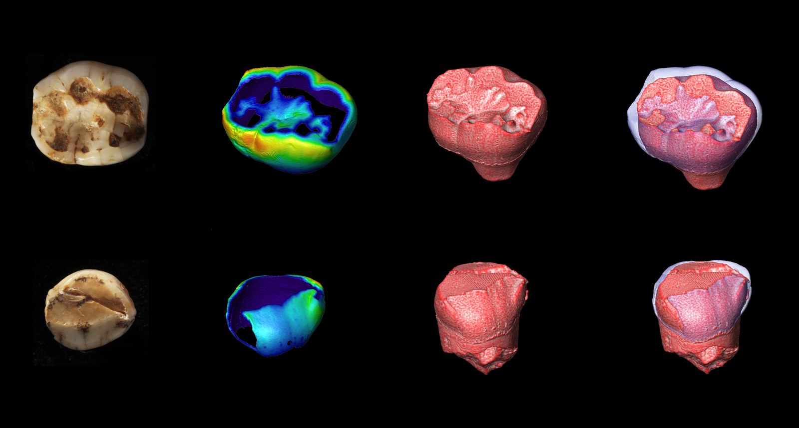 Structure interne de dents d’enfants. Les micro-CT scans des dents déciduales d’enfants (molaire et canine) de la Caune de l’Arago offrent un regard nouveau sur la morphologie dentaire. La cartographie (multicolore) renseigne sur l’épaisseur de l’émail et sa distribution, la jonction entre l’émail et la dentine (en rouge) informe sur la structure qui a disparu à la surface de l’émail. L'Homme de Tautavel.