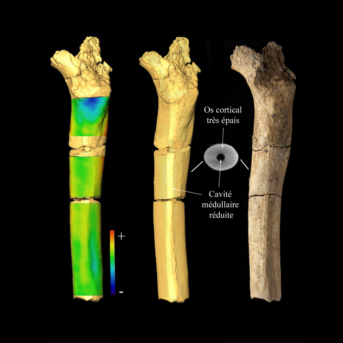 Structure interne d’un fémur adulte (A141). La structure interne du fémur A141 est rendu visible par l’imagerie à rayon x. Le traitement de la séquence d’images permet de quantifier l’os cortical et de réaliser une cartographie de sa distribution. L'Homme de Tautavel.