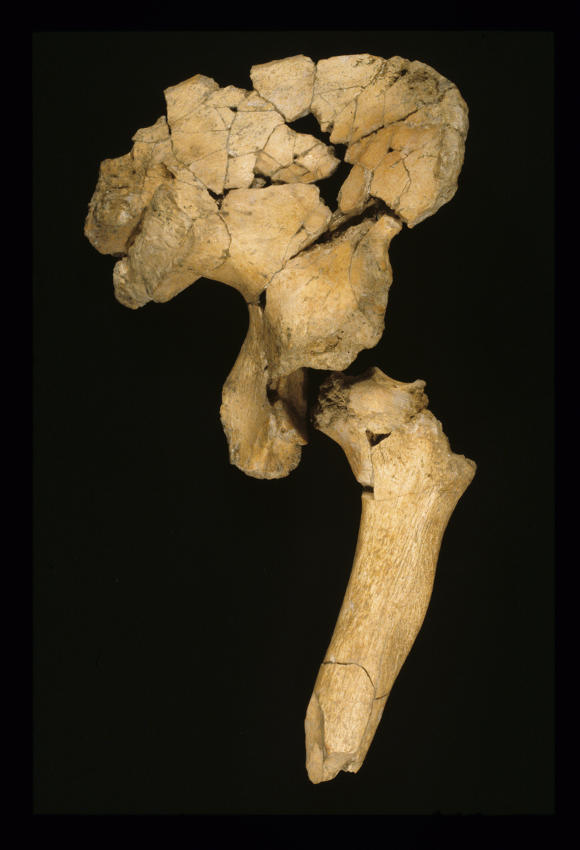 Pelvis A44 et fémur A57 (1978, 1982)