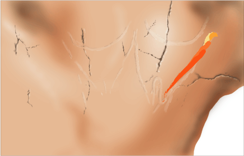 Phases d'exécution 4