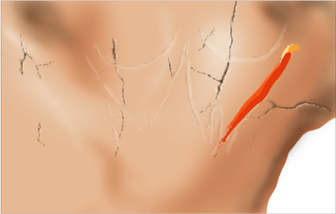 Phases d'exécution 5