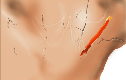 Phases d'exécution 7