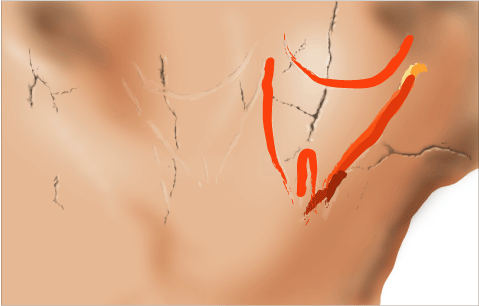 Phases d'exécution 8