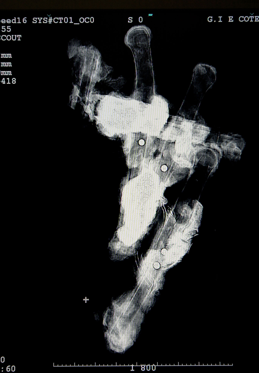 Radiographie d'un lot de cinq pistolets