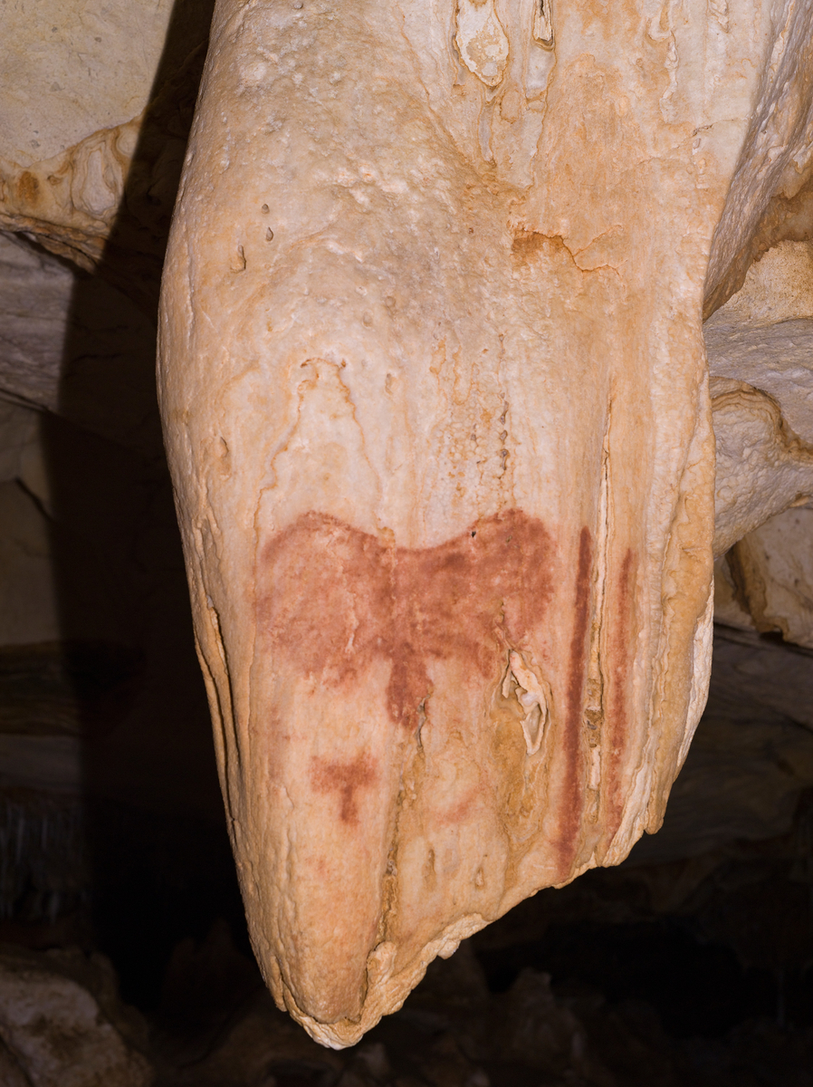 Signe en « papillon »