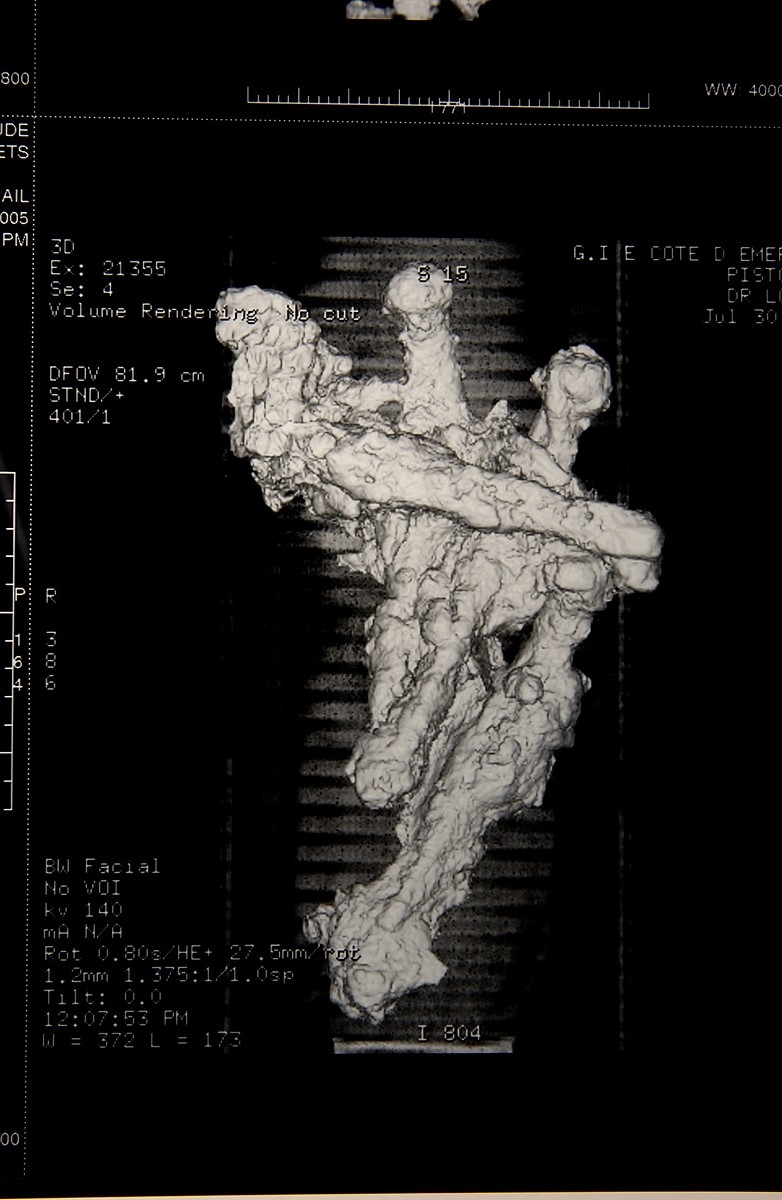 Image du scanner d'un pistolet trouvé sur une épave